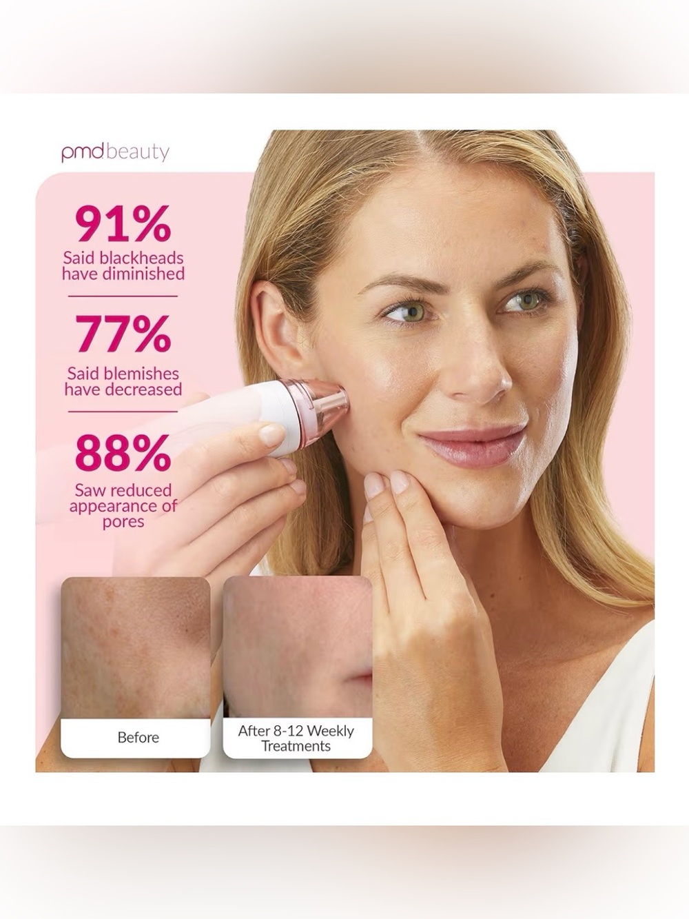 PMD Microderm PRO - Picture 8 of 9